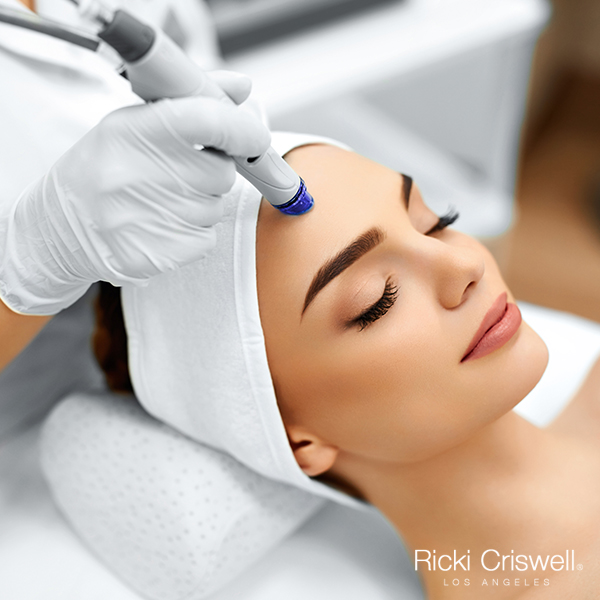 microdermabrasion